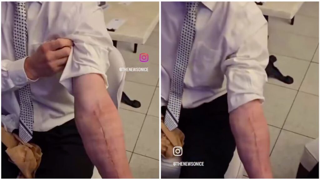 North Carolina Candidate Brian McGinnis Shows Surgical Scars After Hearing Removal: ‘I Truly Hope He Sues’ North Carolina